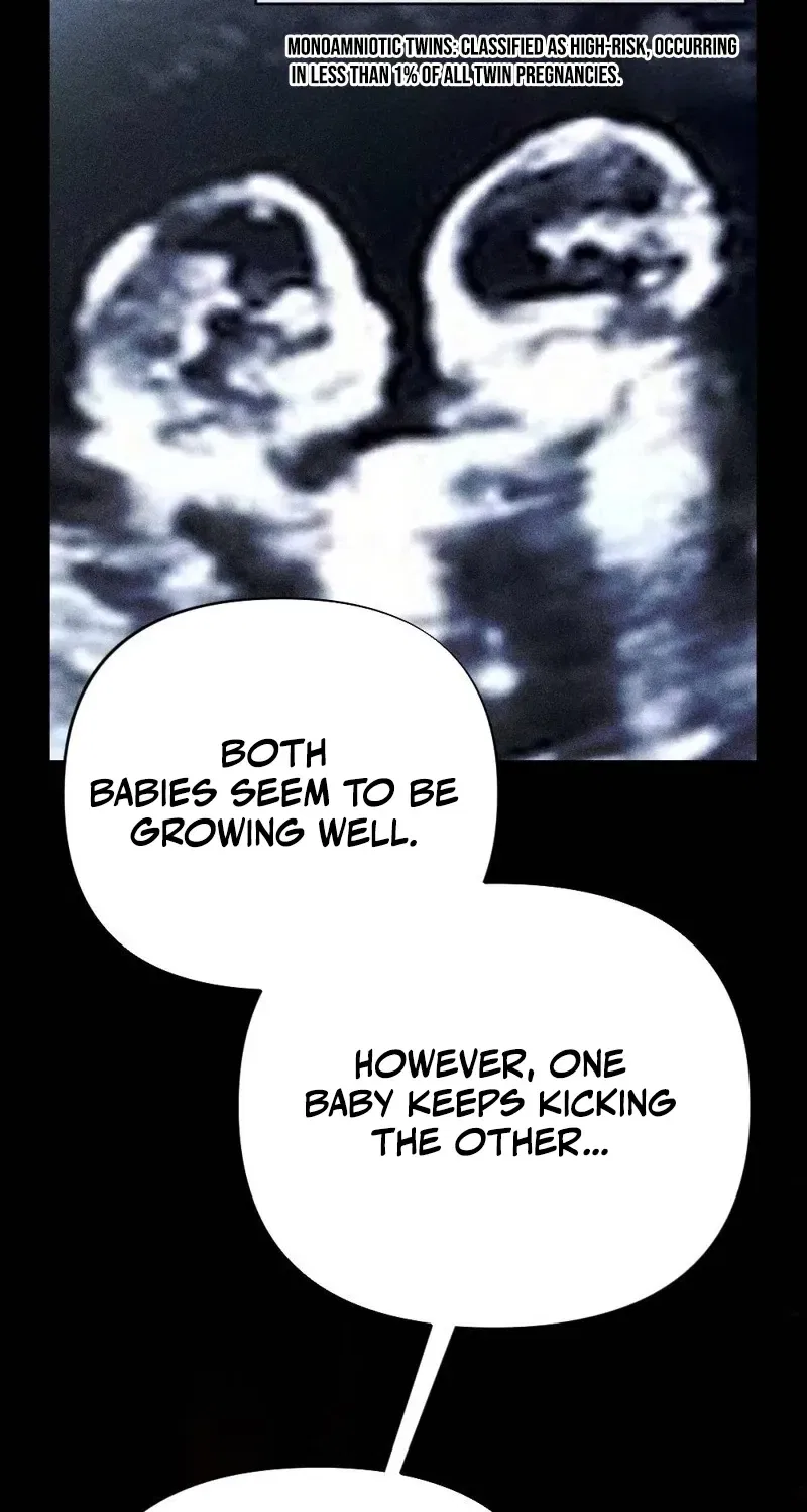 The Child I Secretly Gave Birth To Chapter 2 – Page 84
